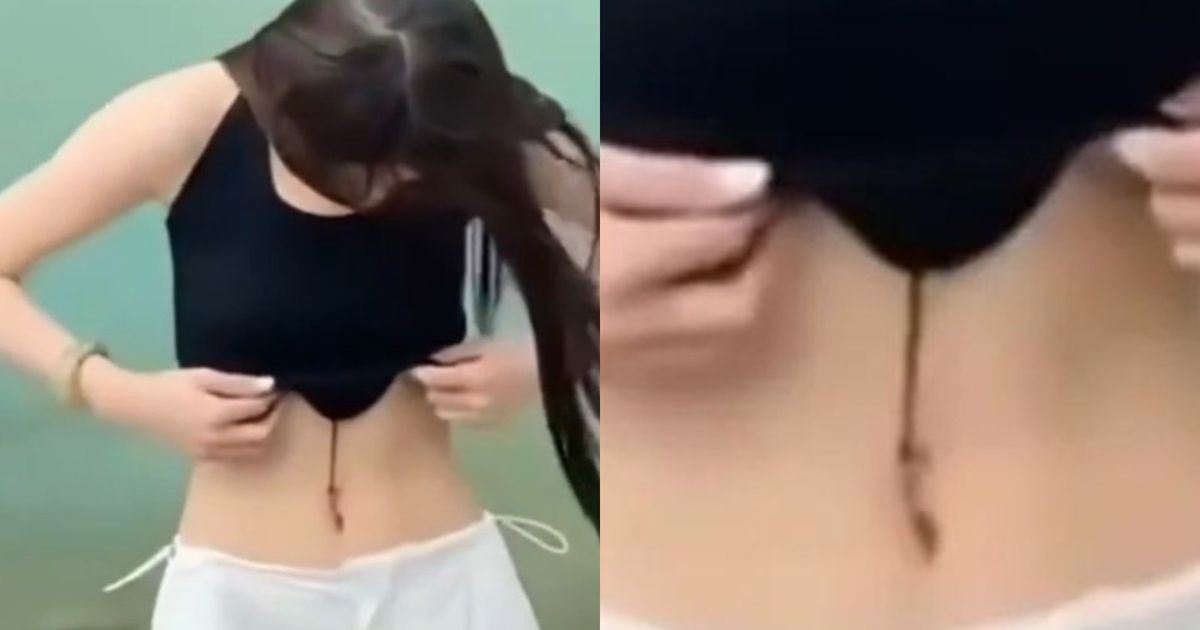 Khoe eo thon bên hồ, cô gái hồn bay phách lạc vì đỉa bám hút máu trên người缩略图
