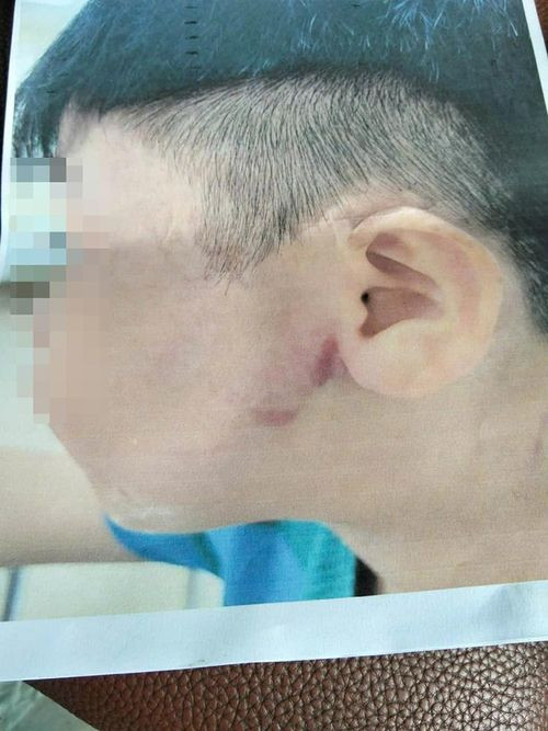 Điều tra vụ bé trai 9 tuổi nghi bị cha ruột bạo hành ở TPHCM缩略图