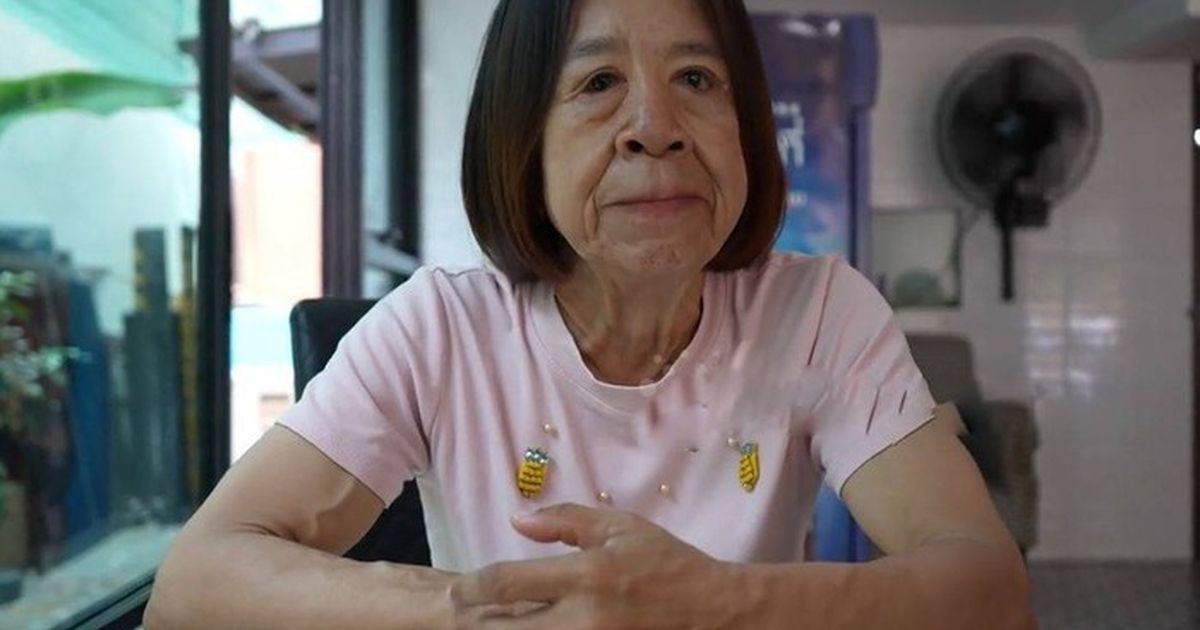 Suốt nhiều năm bị dị nghị do mắc hội chứng hiếm gặp, cô gái 29 tuổi hy vọng &amp;apos;đổi đời&amp;apos; ca phẫu thuật thay đổi diện mạo缩略图