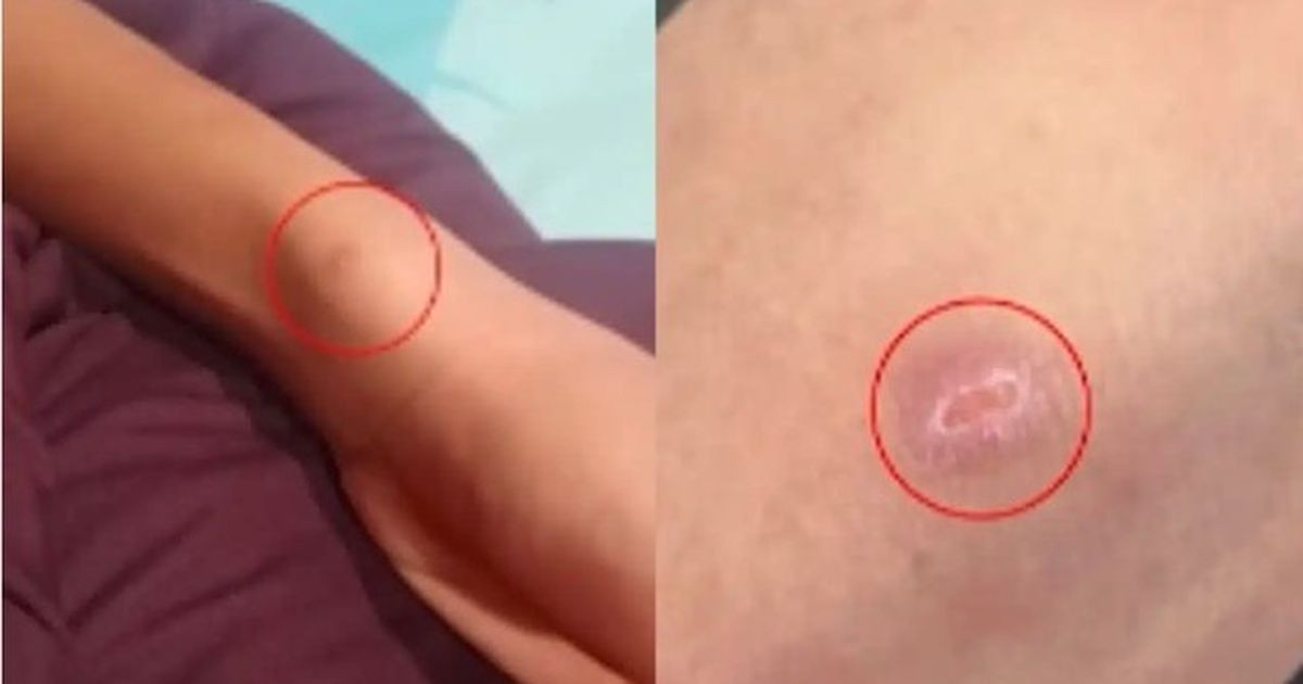 Thấy con trai người đầy vết thương, bố mẹ chết lặng khi nghe em kể chuyện đau lòng xảy ra suốt 2 năm ở trường缩略图