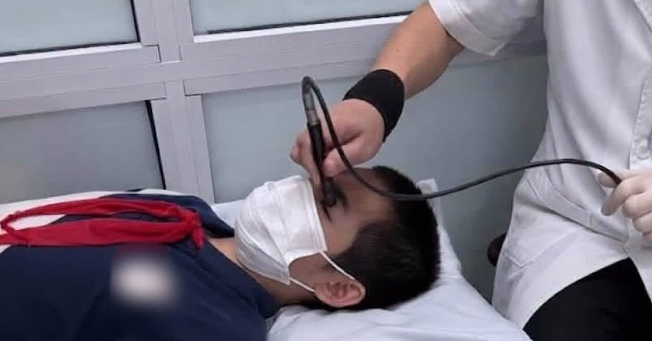 Bé trai 13 tuổi vỡ nhãn cầu sau cú bật ô của bạn缩略图