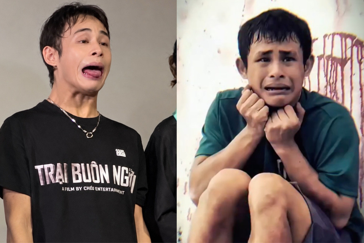 Chàng trai mắc hội chứng lạ gây sốt trong phim &amp;apos;Trại buôn người&amp;apos;缩略图