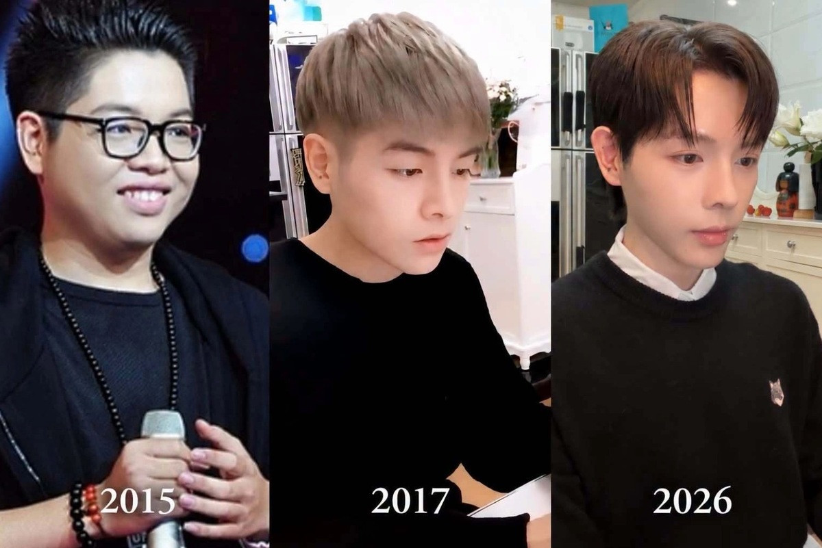 Từng bị chê xấu xí, ngoại hình Đức Phúc thay đổi thế nào sau 11 năm đi hát?缩略图